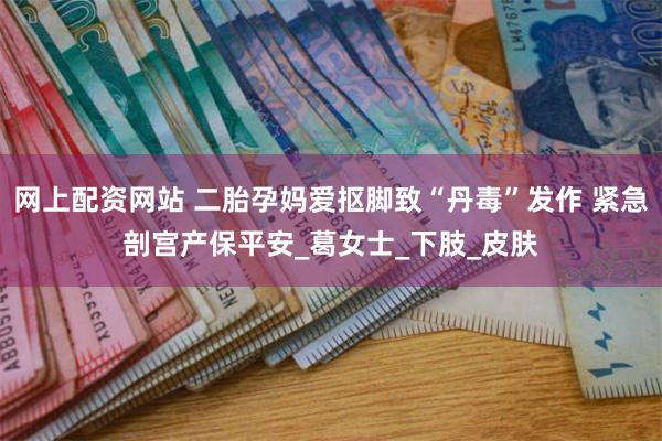 网上配资网站 二胎孕妈爱抠脚致“丹毒”发作 紧急剖宫产保平安_葛女士_下肢_皮肤